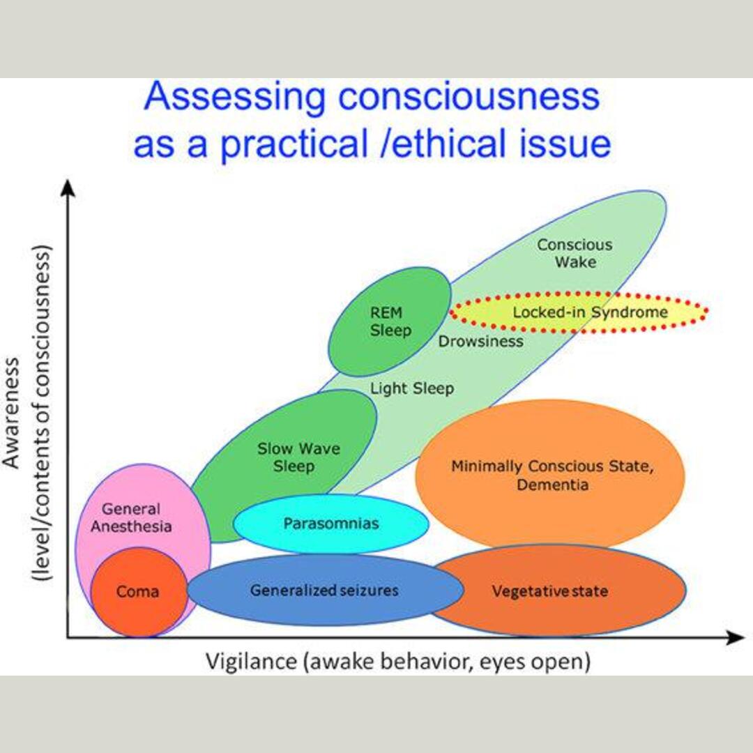 Levels of Consciousness (awake behavior, eyes open)
