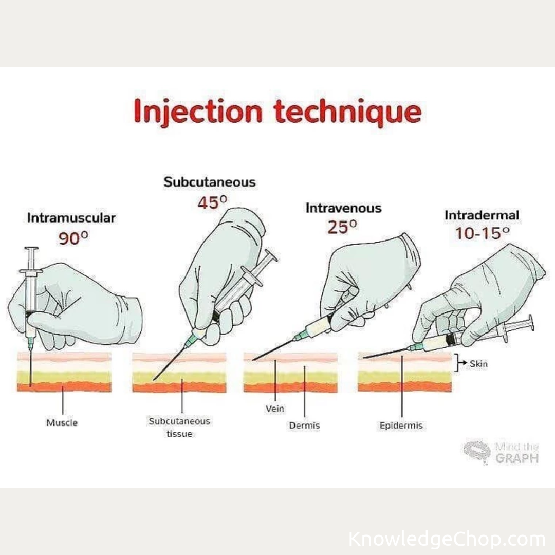 injection technique | 🥷 Knowledge Ninja